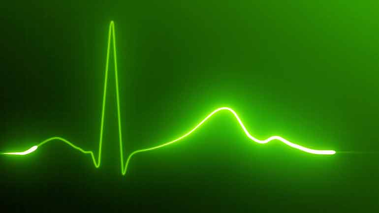 Blip on an EKG