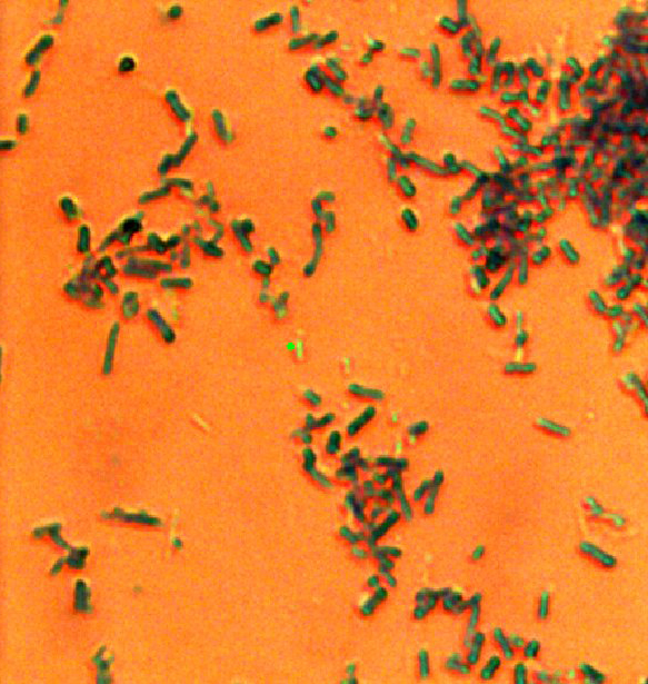 E coli bacteria under an optical microscope.