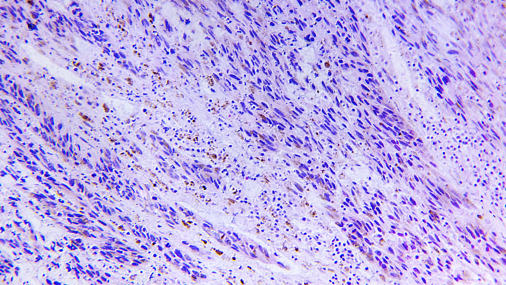 Cells under a microscope