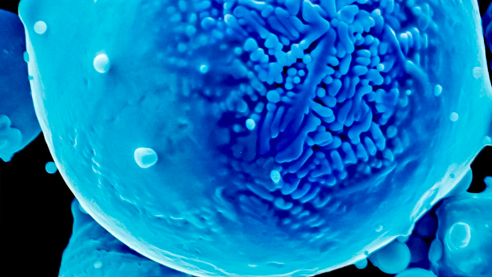 Zoomed image of a nickel alloy powder.
