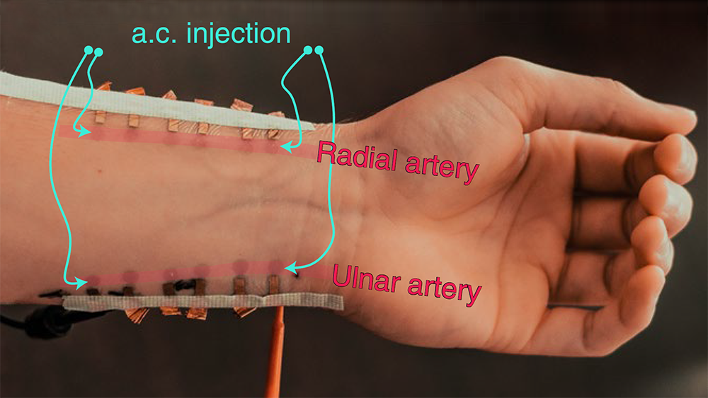 E-tattoos are worn on the wrist, and are designed for continual blood pressure monitoring. 