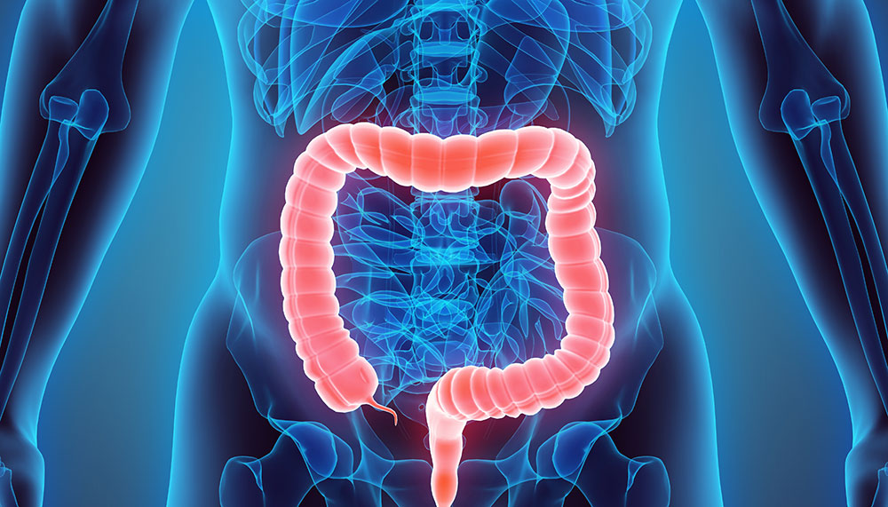 X-ray type graphic of large intestine